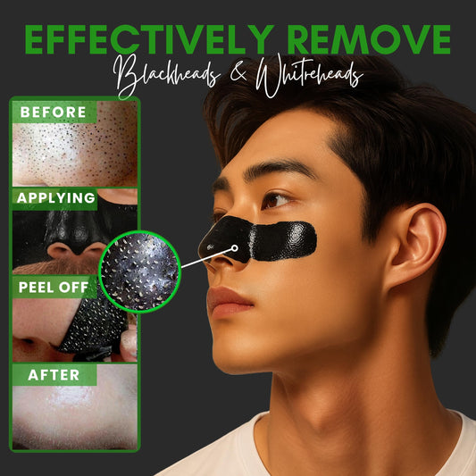 Blackhead Remover Mask: Charcoal Peel Off Face Mask Kit for Pores Deep Cleansing and Purifying – Facial and Nose Mask for All Skin Types with Tools 🍁 All In One Marketplace Canada