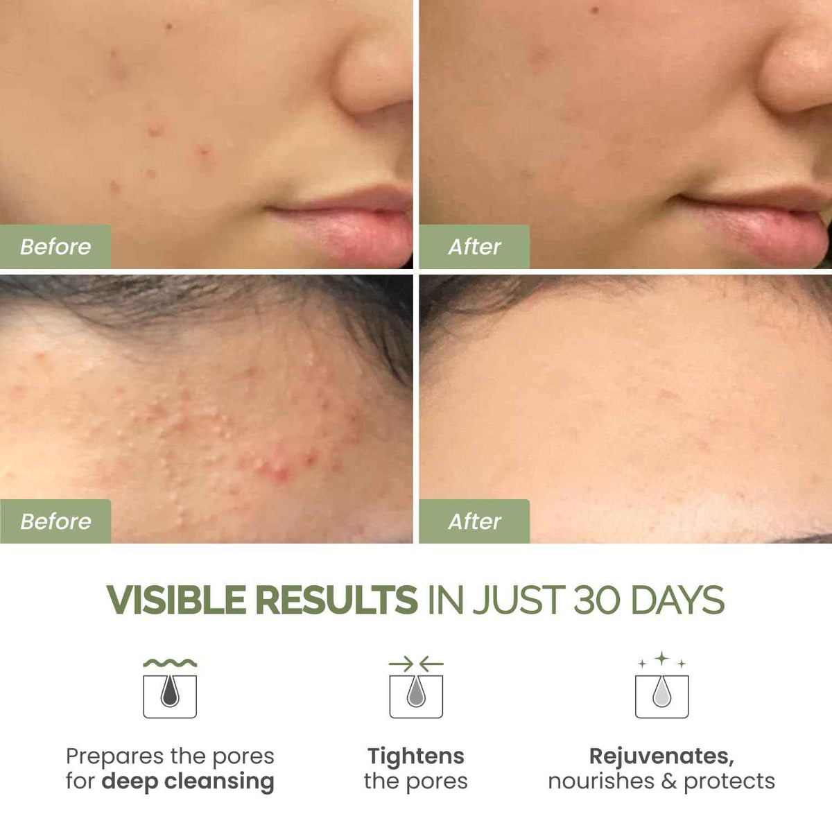 PLANTIFIQUE Clay Mask with Avocado & Superfoods - Korean Face Masks Skincare Products - Dermatologically Tested - Masque Visage Beauté - Gift Idea, 110g / 3.88 fl oz 🍁 All In One Marketplace Canada