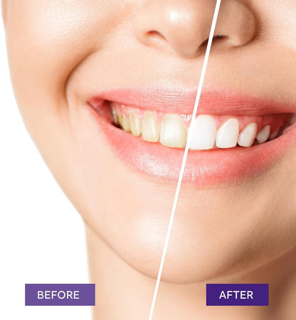 Teeth Whitening Purple Toothpaste- Toothpaste Whitening, Teeth Whitening Toothpaste, Purple Toothpaste Teeth Whitening, Tooth Whitening, Teeth Whitening Gel 30ml 🍁 All In One Marketplace Canada