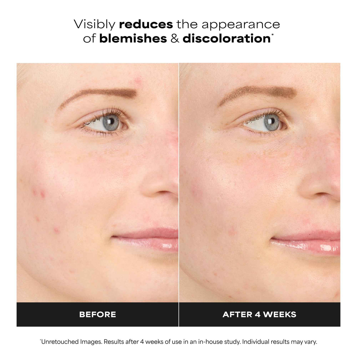 Paula's Choice BOOST 10% Azelaic Acid Booster Cream Gel, Licorice Extract & Salicylic Acid, Oil-Free Skin Serum, Fragrance-Free, 30 ml 🍁 All In One Marketplace Canada