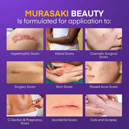 Silicone Scar Gel Scar Cream - SPF 30 Advanced Scar Gel for Old and New Scars 🍁 All In One Marketplace Canada