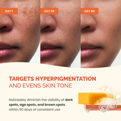 PLANTIFIQUE Kojic Acid Soap for Hyperpigmentation, Lab Tested - Turmeric Soap 2 Bars with Hyaluronic Acid, Collagen, Vitamin C for Dark Spots - Face Wash, 160g / 5.64 oz 🍁 All In One Marketplace Canada