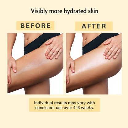 Firming Body Massage Oil with Collagen & Stem Cell – Helps Smooth the Appearance of Cellulite & Improve Skin Texture – Refreshing Aromatherapy Oil for Legs & Full Body – 8 fl oz by M3 🍁 All In One Marketplace Canada