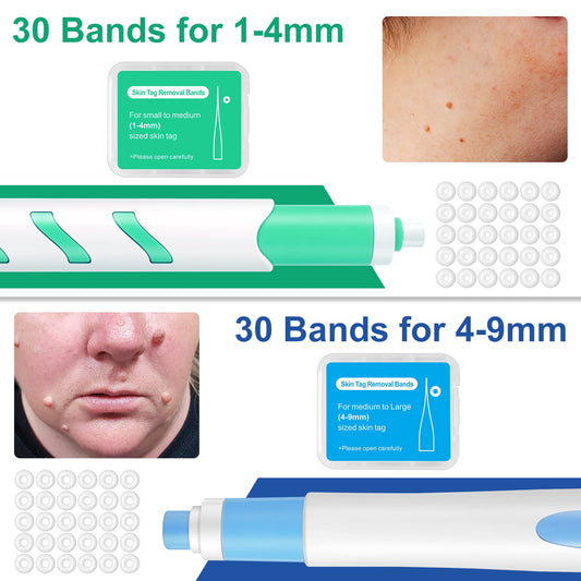 Skin Tag Tool，For Small to Large Skin Tags 1-9mm Painless Skin Tag Removal Kit Tools with 60 Removal Bands And 36 Repair Patches & 20 pcs Cleansing Wipes Easy to Use 🍁 All In One Marketplace Canada