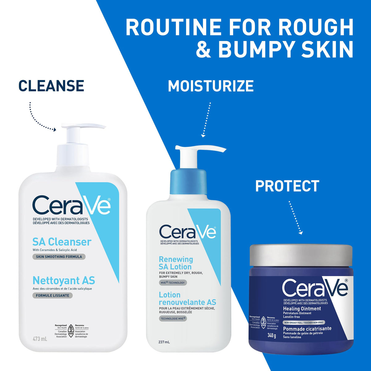 CeraVe SALICYLIC ACID Lotion, Renewing SA Exfoliating Body Lotion for Dry, Rough & Bumpy Skin, Psoriasis, Keratosis Pilaris, Itching & Flaking. With Lactic Acid, Hyaluronic Acid, Fragrance Free, 237ML 🍁 All In One Marketplace Canada