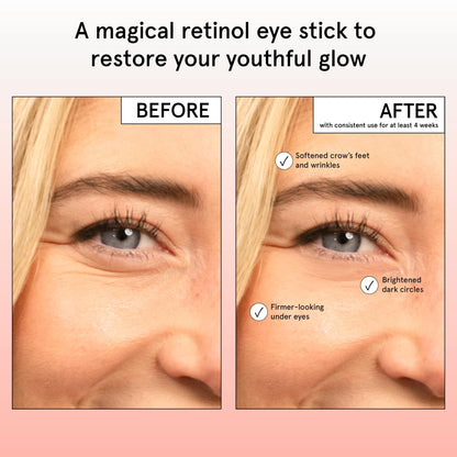 grace & stella Retinol & Caffeine Eye Cream Stick - Under Eye Cream for Dark Circles, Anti-Aging, Puffiness, Wrinkles, Undereye Bags - Brightener with Niacinamide - Vegan Skincare (0.13 oz/3.5 g) 🍁 All In One Marketplace Canada