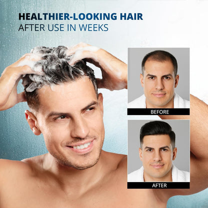 Root Activator Shampoo: 300ML Natural Volume Hair Loss Thickening Shampoo With Rosemary Strengthens Hair & Soothes Scalp For Men 🍁 All In One Marketplace Canada