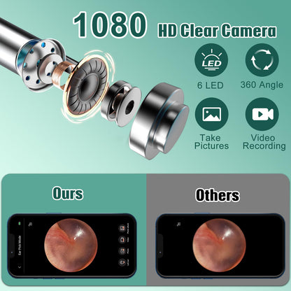 LMECHN Ear Wax Removal, Ear Cleaner with 7 Pcs Ear Set, Ear Wax Removal Tool Camera with 1080P Ear Otoscope & 6 LED Lights, Wireless Ear Pick for Ear Cleaning with 6 Ear Spoons Black 🍁 All In One Marketplace Canada