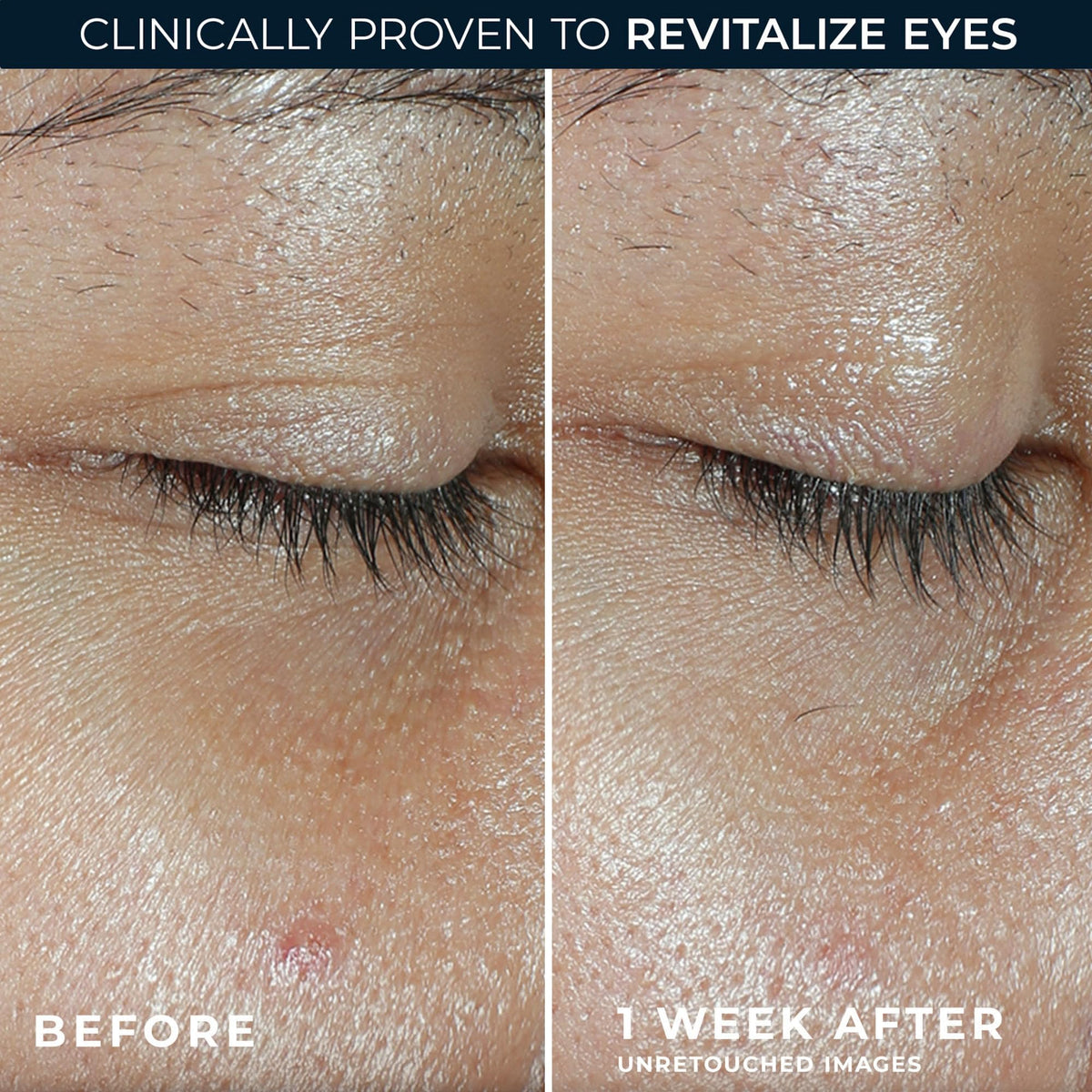 RoC Multi Correxion Revive + Glow Vitamin C with Peptides Eye Balm for Brighter Eyes 4G 🍁 All In One Marketplace Canada