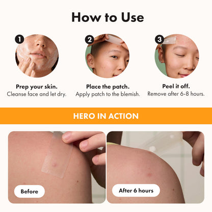 Hero Cosmetics Mighty Patch Surface – Large Hydrocolloid Patch for Pimples on the Body, Back and Face, Suitable for Sensitive Skin, 10 Count 🍁 All In One Marketplace Canada
