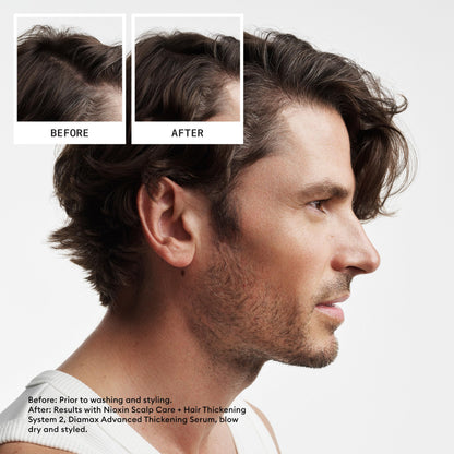 Nioxin Scalp + Hair Thickening System 2 - Hair Thickening System for Natural Hair with Progressed Thinning, Full Size (Packaging May Vary) 🍁 All In One Marketplace Canada
