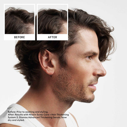 Nioxin Scalp + Hair Thickening System 2 - Hair Thickening System for Natural Hair with Progressed Thinning, Trial Size (Packaging May Vary) 🍁 All In One Marketplace Canada