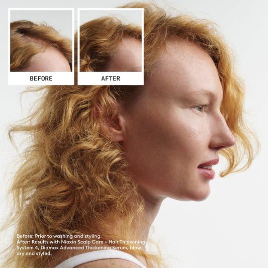 Nioxin Scalp + Hair Thickening System 4 - Hair Thickening System for Colored Or Dry Damaged Hair with Progressed Thinning, Full Size (Packaging May Vary) 🍁 All In One Marketplace Canada