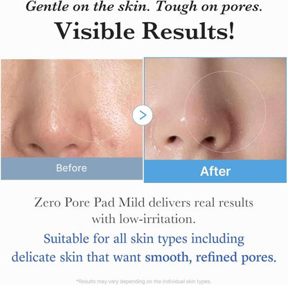 Medicube Zero Pore Mild Pad 155g / 70 pads