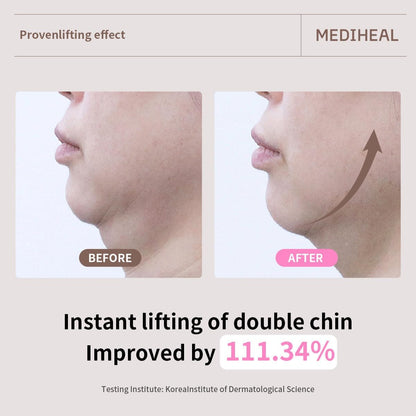 Mediheal Retinol Collagen Ampoule Lifting Mask 30ml